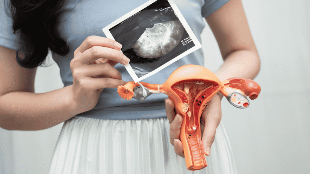 A Histeroscopia Diagnóstica e Cirúrgica | Dra. Nadine Ziegler | Ginecologia e Reprodução Assistida