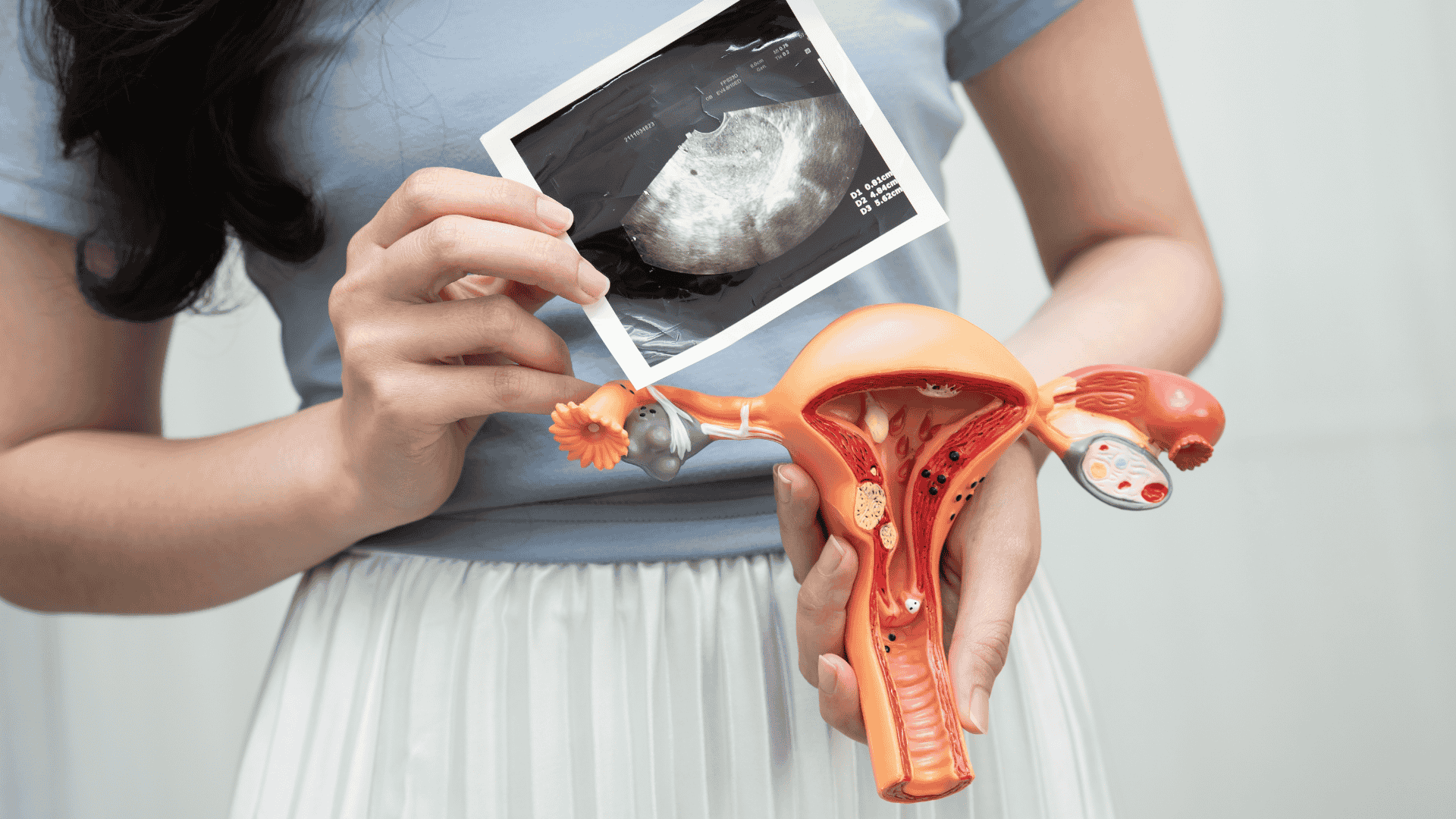 A Histeroscopia Diagnóstica e Cirúrgica | Dra. Nadine Ziegler | Ginecologia e Reprodução Assistida