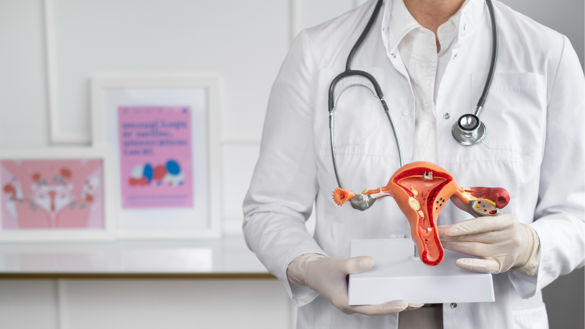 SOP | Dra. Nadine Ziegler | Ginecologia e Reprodução Assistida